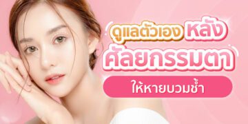 Shopee blog วิธีลดบวมหลังศัลยกรรมตา