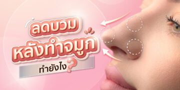 Shobee Blog วิธีลดบวมหลังทําจมูก