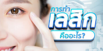 Lasik เลสิก คือ เลสิค